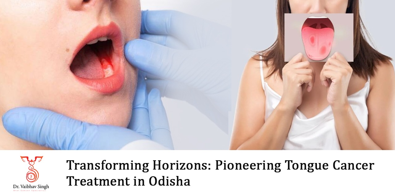 tongue cancer treatment in Odisha